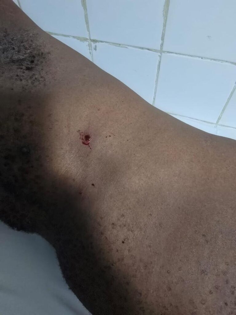 Fusillade à la MATCA