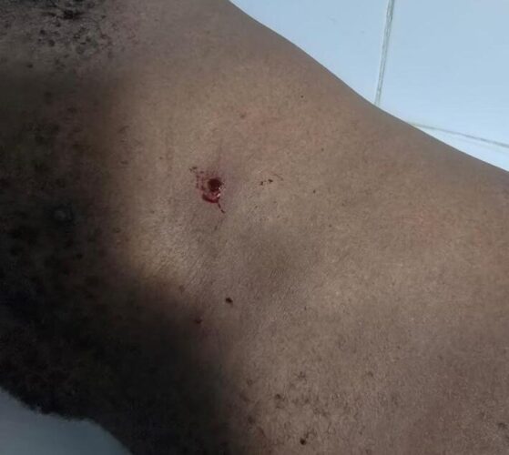 Fusillade à la MATCA